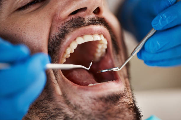 Best Knocked-Out Tooth Emergency  in Bellmawr, NJ